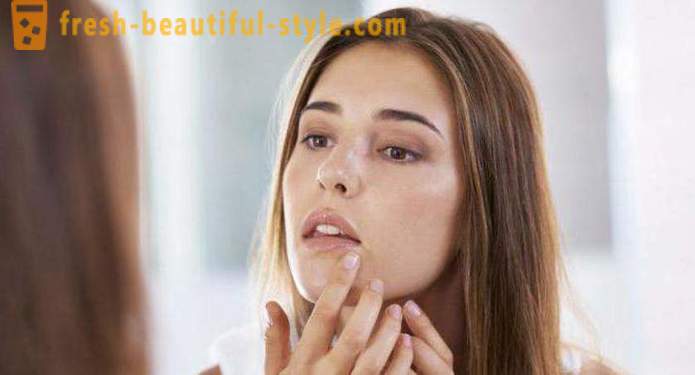 Miért sokan pattanások az arcodon? Okai és kezelési módszerek
