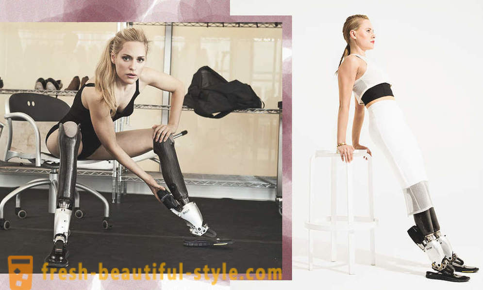 Végtelen Beauty: 6 női modellek protézisek