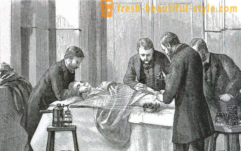 Megdöbbentő tények a viktoriánus műtét