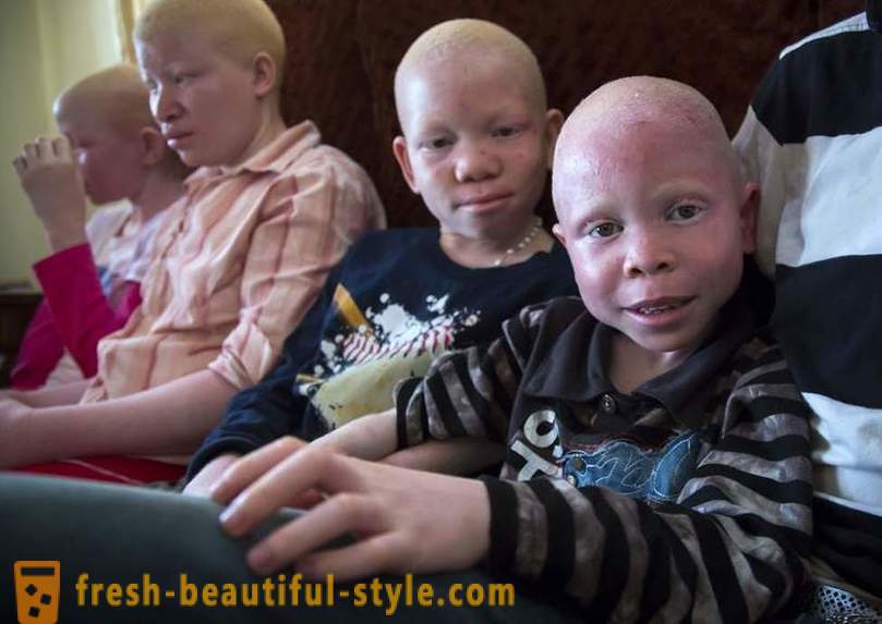 A tragikus története tanzániai albínók