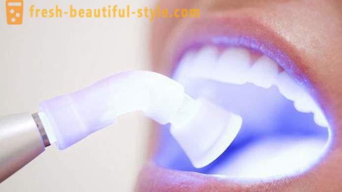 7 káros anyagok a fogakhoz, ami még nem is tudott
