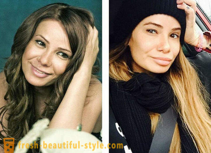 10 orosz szépségek előtt és után plasztikai