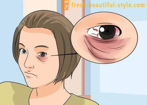 Hogyan maszk fekete szeme egy csapás: kozmetikumok, különösen ajánlásokat és