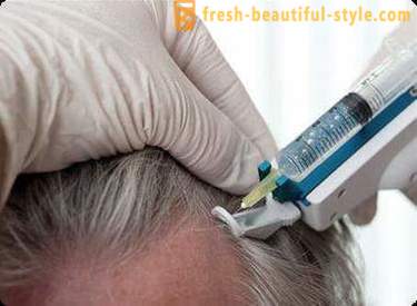 Mezoterápia haj: smink eszközök és ellenjavallatok