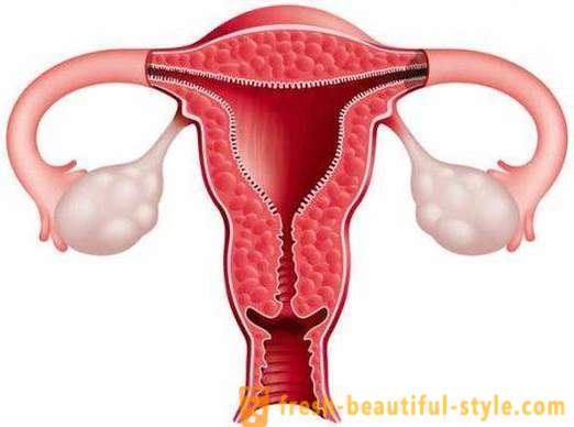 Hogyan növelhető az endometrium